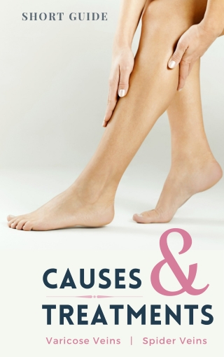 Causes and Treatments of Varicose Veins and Spider Veins
