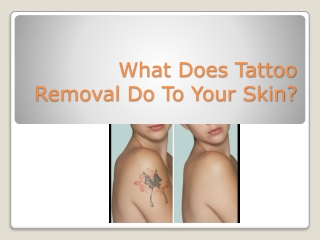 What does tattoo removal do to your skin