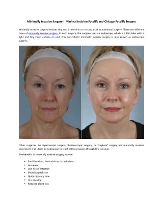 Minimally Invasive Surgery | Minimal Incision Facelift and Chicago Facelift Surgery
