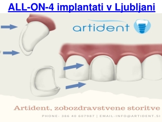 ALL-ON-4 implantati v Ljubljani