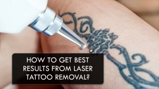 Basic Tips to Get Best Results From Laser Tattoo Removal