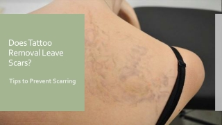 Does Tattoo Removal Leave Scars? Important Tips to Prevent Scarring