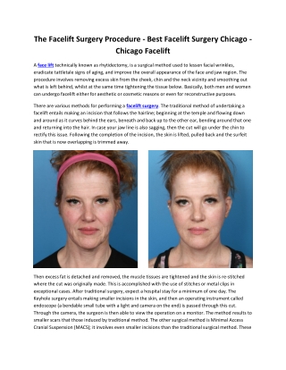 The Facelift Surgery Procedure - Best Facelift Surgery Chicago - Chicago Facelift