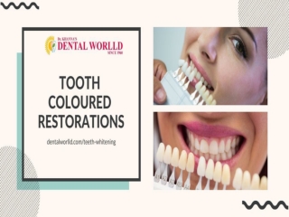 TOOTH  COLOURED  RESTORATIONS
