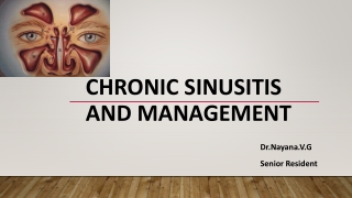 Chronic sinusitis and management