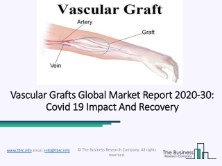 Vascular Grafts Market Global Industry Analysis By Trends, Size, Share, Company Overview, Growth And Forecast 2023