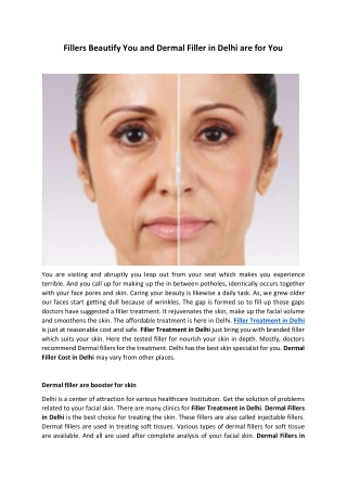 Fillers Beautify You and Dermal Filler in Delhi are for You