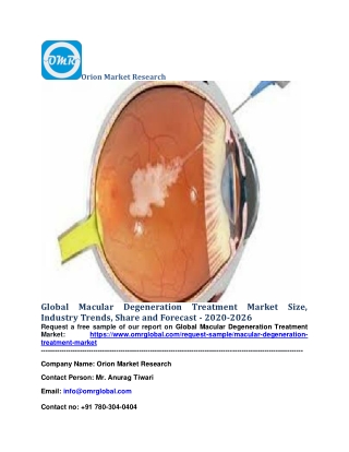 Global Macular Degeneration Treatment Market Size, Industry Trends, Share and Forecast - 2020-2026