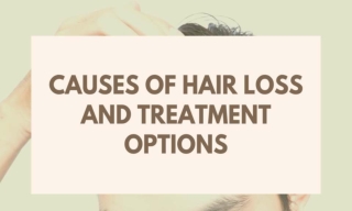 Causes Of Hair Loss and Treatment Options