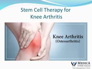 Medica Stem Cell fro Knee Arthritis