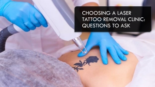 How to Choose Laser Tattoo Removal Clinic