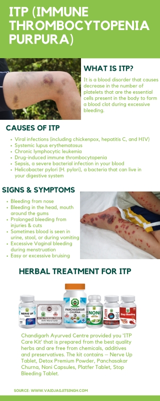 ITP (immune thrombocytopenia purpura) - Causes, Symptoms and Herbal Treatment