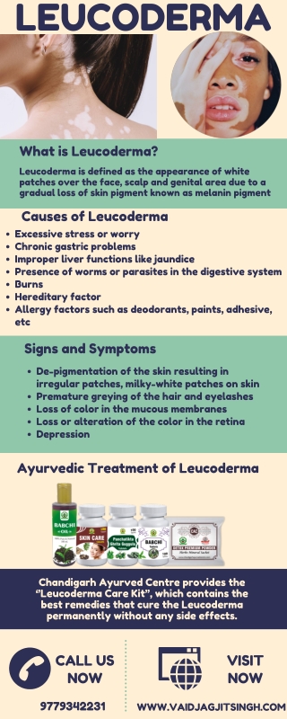 Leucoderma  - Causes, Symptoms and Herbal Treatment