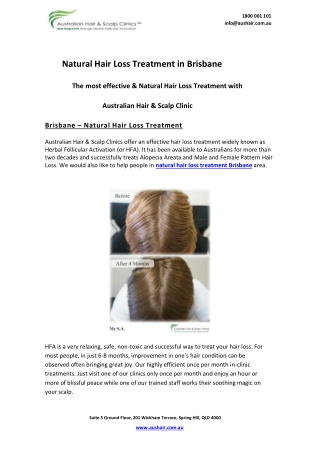 Natural hair loss treatment in brisbane