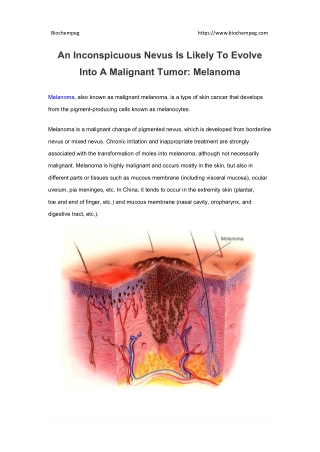 An Inconspicuous Nevus Is Likely To Evolve Into A Malignant Tumor: Melanoma