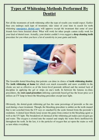 Types of Whitening Methods Performed By Dentist