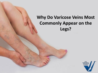 Why Do Varicose Veins Most Commonly Appear on The Legs?