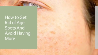 How to Get Rid of Age Spots And Avoid Having More