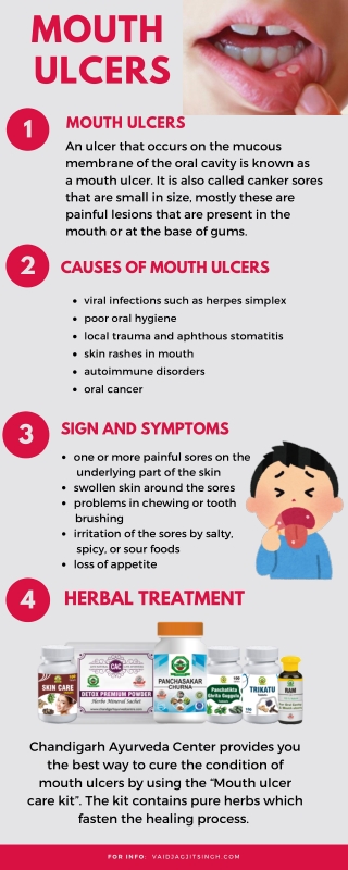 Mouth Ulcers - Causes, Symptoms and Herbal Treatment