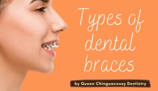 Dental Braces Types by Queen Chinguacousy Dentistry