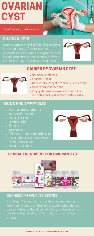 Ovarian Cyst - Causes, Symptoms and Herbal Treatment