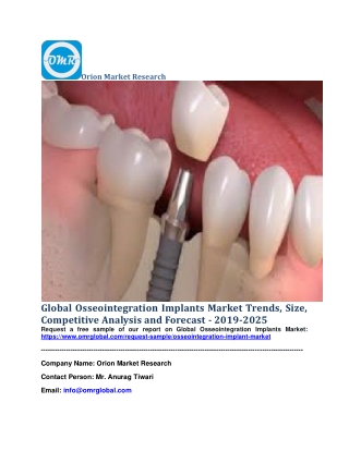 Global Osseointegration Implants Market Trends, Size, Competitive Analysis and Forecast - 2019-2025
