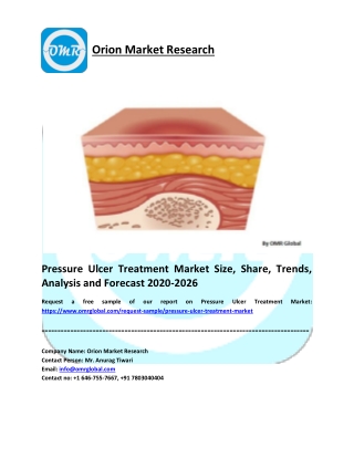 Pressure Ulcer Treatment Market Size, Share, Trends, Analysis and Forecast 2020-2026