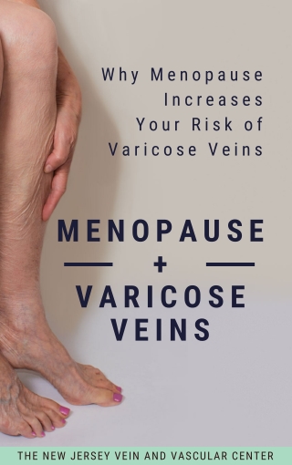 The Relation Between Menopause and Risk of Varicose Veins