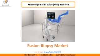 Fusion Biopsy Market Size Worth $912.5 Million By 2026 - KBV Research