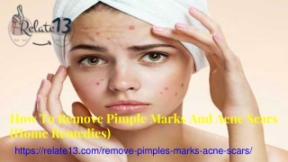 How To Remove Pimple Marks And Acne Scars (Home Remedies)