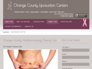 Liposuction Surgeons Orange County