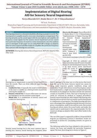 Implementation of Digital Hearing AID for Sensory Neural Impairment