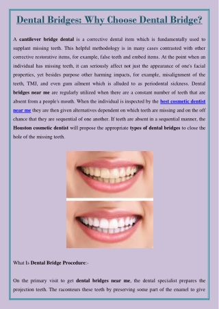 Dental Bridges: Why Choose Dental Bridge?