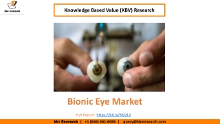 Bionic Eye Market Size Worth $416.5 Million By 2026 - KBV Research