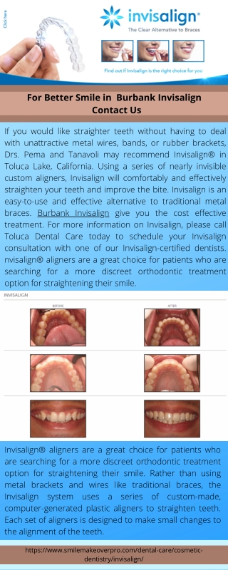 For Better Smile in Burbank Invisalign Contact Us