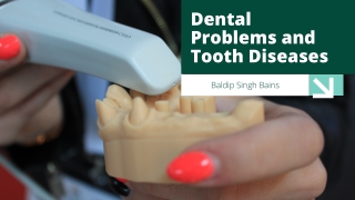 Dental Problems and Tooth Diseases