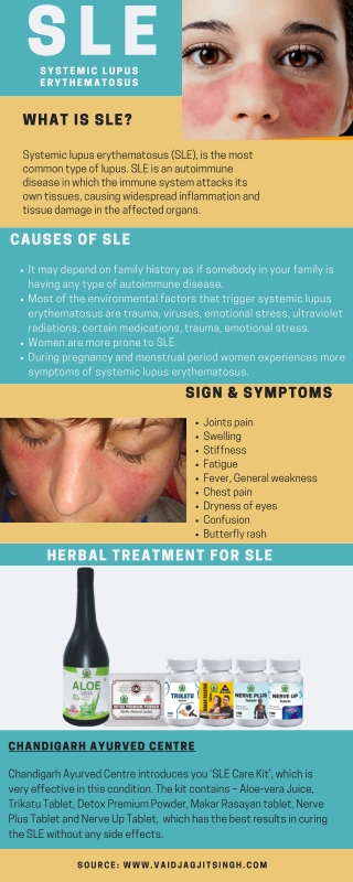 Systemic lupus erythematosus (SLE) - Causes, Symptoms & Herbal Treatment