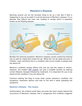 Meniere's disease