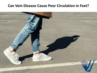 Can Vein Disease Cause Poor Circulation in Feet? | USA Vein Clinics