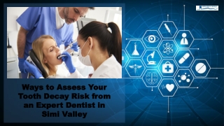 Ways to Assess your Tooth Decay Risk from an Expert Dentist in Simi Valley