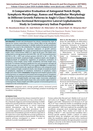 An Experimental Investigation on Pervious Concrete Road using Cotton Waste