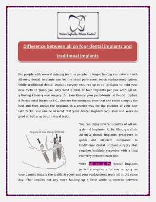 Difference between all on four dental implants and traditional implants