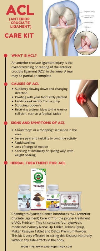 ACL - Causes, Symptoms & Herbal Treatment