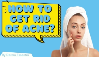 How to Get Rid of Acne?