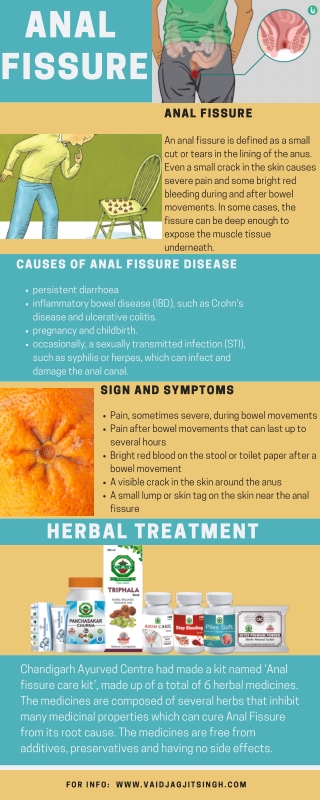 Fissure - Causes, Symptoms & Herbal Treatment