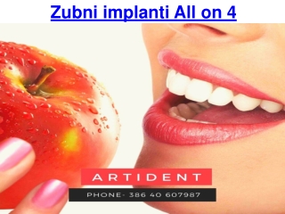 Zubni implanti All on 4