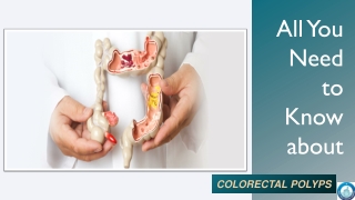 All You Need to Know about COLORECTAL POLYPS