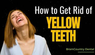 How to Get Rid of Yellow Teeth by Dentist in Brampton