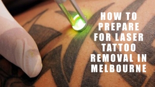 How to Prepare For Laser Tattoo Removal in Melbourne