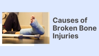 California Broken Bones Attorneys